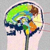 Graphical depiction of the Knowledge-Guided Deformable Registration project