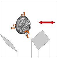 Graphical depiction of the Medical Image Registration project