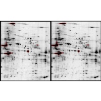 Portrait of Automatic Segmentation of Proteomic Images