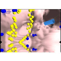Graphical depiction of the Computer Assisted Medical Instrument Navigation project