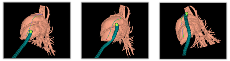 Graphical depiction of the Medical AI: BodySLAM project