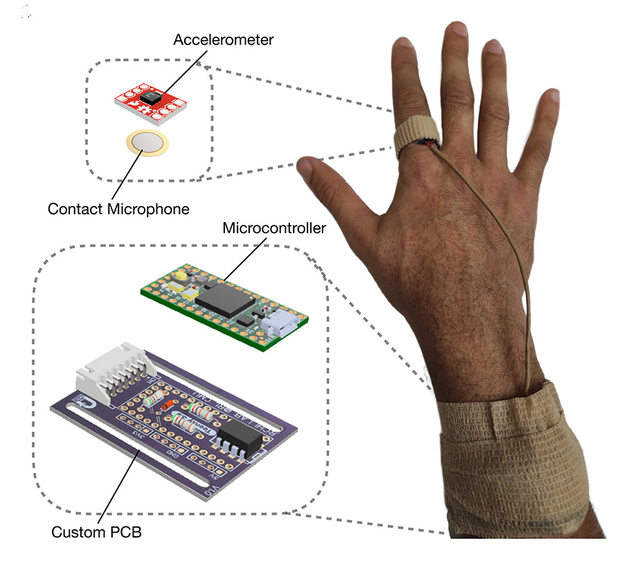 Image for CMU Sensor Objectively Measures Scratching Intensity
